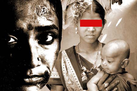  that Indian mothers and children are suffering from chronic malnutrition 