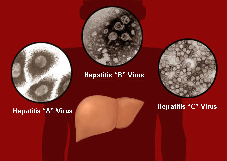 Hepatitis or simply put inflammation of the liver ranges from being a simple 