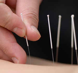 Acupuncture for Menstrual Pain
