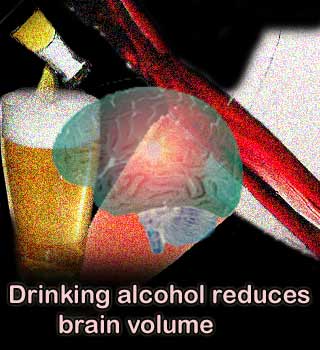 Alcohol Brain