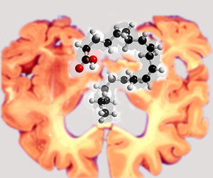 Alzheimer Brain, Fatty Acid