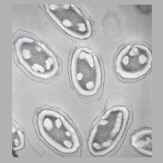 Bacillus Anthracis spores