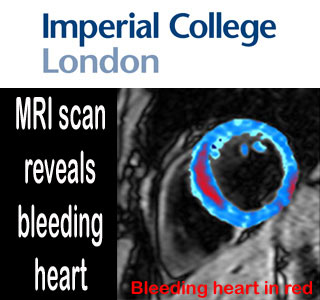 Bleeding Heart Scan