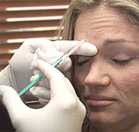 Woman getting Botox Treatment