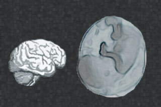 Brain, Fetus Silhouette
