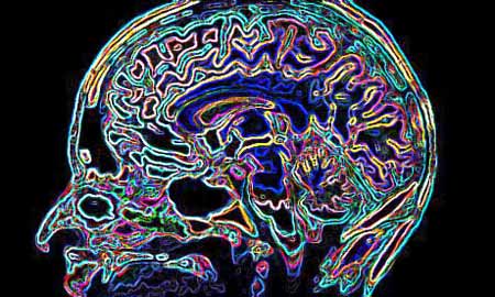 MRI of Human Brain