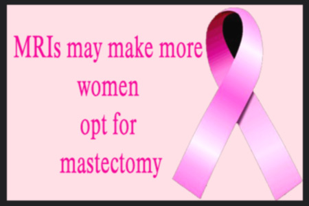 Mastectomy and Breast Cancer