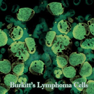 Burkitt’s Lymphoma Cells