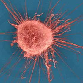 Breast Cancer Cell