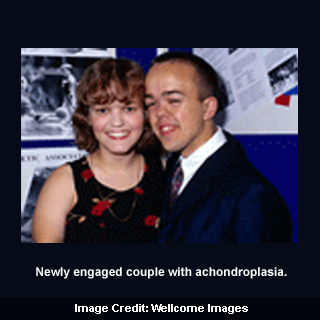 Couple With Achondroplasia