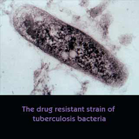 TB Bacteria