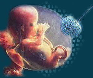 Embryo, Genetic Test
