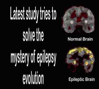 Normal Brain and Epileptic Brain