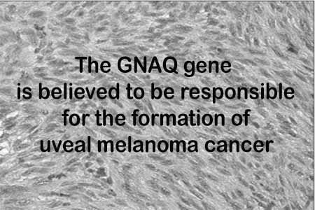 GNAQ gene text