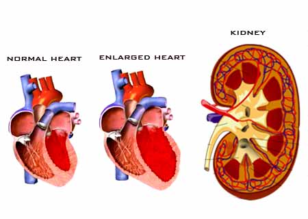 Heart and Kidneys