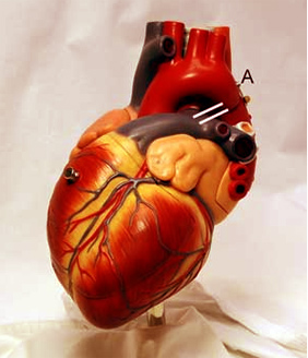Model of a Heart