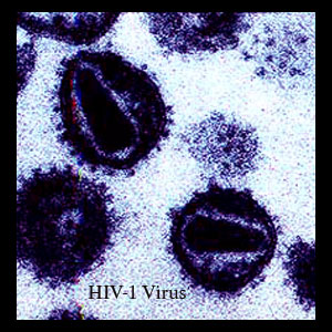 HIV-1 virus