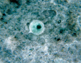 Infectious Disease under Microscope