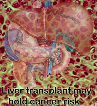 Liver, Cancer