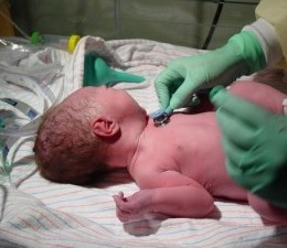 A doctor examining a newborn with a low birth weight