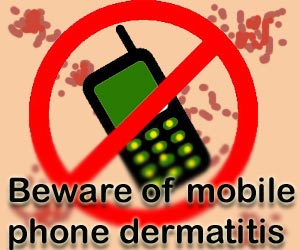 Mobile phone dermatitis