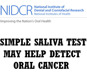NIDCR Saliva Test