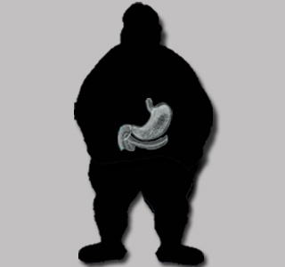 Obesity and Pancreas Silhouette