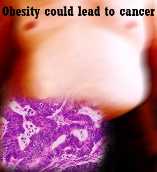 Obesity,Cancer