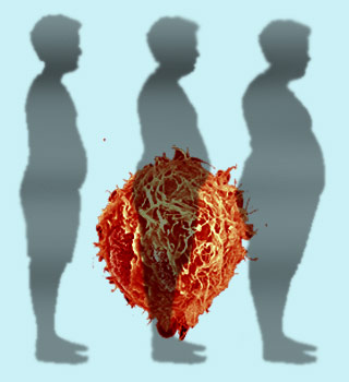 Obesity, Prostate cancer