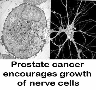 Prostate cell, Nerve cell