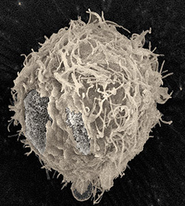 Prostate Camcer Cell