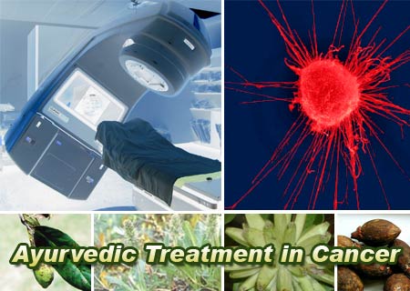 Radiation Machine, Cancer Cell, Herbs