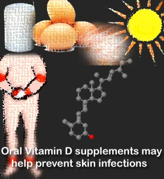 Vitamin D, Skin Infection
