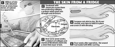 Skin replicating Procedure