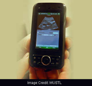 Smartphone-compatible USB ultrasound probe