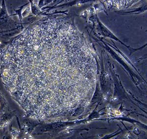 Stem Cell Embryo