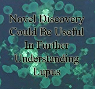 Text, Lupus Cells