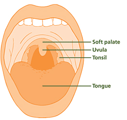 Child Tonsil
