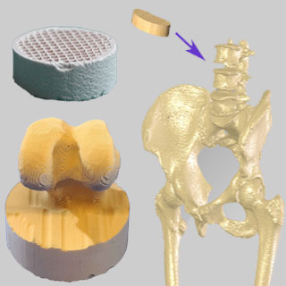 Bone Implant Technology