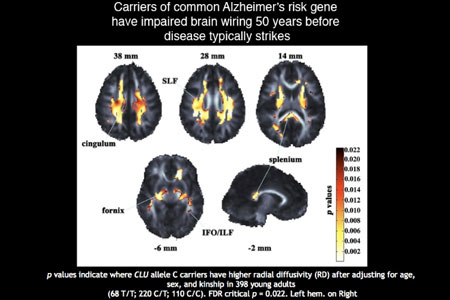 Alzheimer Risk Gene Carriers