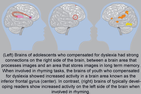 Brain Activity Pattern
