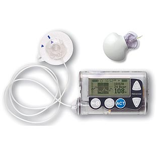 Diabetes Glucose Monitoring