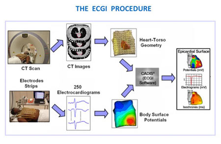 ECGI Procedure