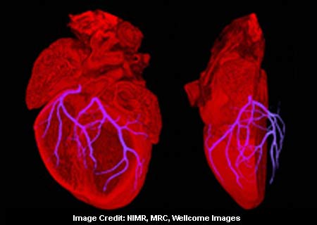 Human Heart Arteries