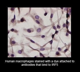 Human Macrophages Dyed