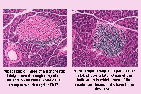 Pancreatic Islet Image