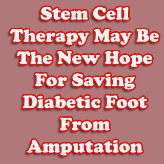 Text Stem Cell Therapy